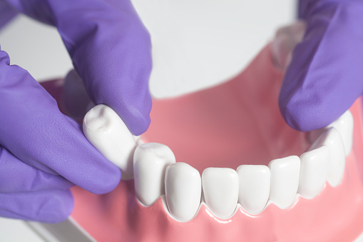 How Long Should My Pain Last After A Tooth Extraction?