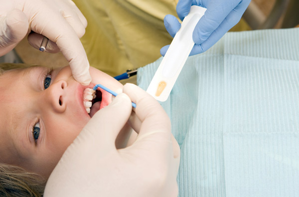 Young boy receiving fluoride treatment at Singing River Dentistry at in Tuscumbia AL 35674-2413